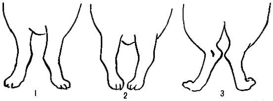 Пороки конечностей: 1 - иксообразная постановка передних ног; 2 - косолапость передних ног; 3 - сближенность скакательных суставов
